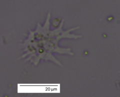 Amoebozoa