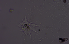Amoebozoa