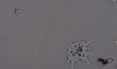 Amoebozoa