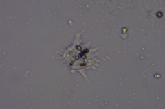 Amoebozoa