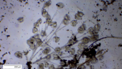 Sessilida
