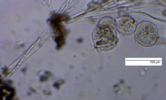 Sessilida