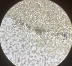 Pleuroflammula tuberculosa