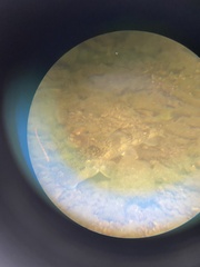 Hypentelium nigricans