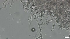 Rhizochaete radicata
