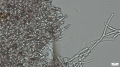 Rhizochaete radicata