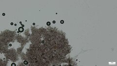 Rhizochaete radicata