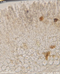 Hymenoscyphus imberbis