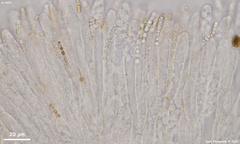 Hymenoscyphus imberbis