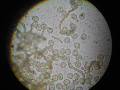 Ophiotheca chrysosperma