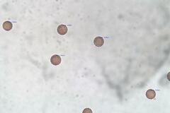 Paradiachea caespitosa