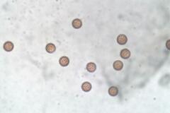 Paradiachea caespitosa