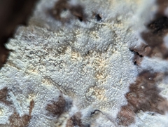 Hyphodontia