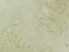 Truncocolumella citrina