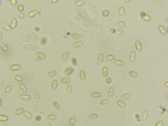 Truncocolumella citrina