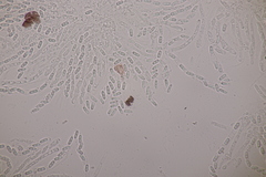 Nectriopsis violacea