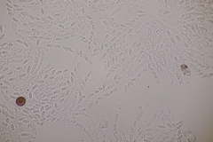 Nectriopsis violacea