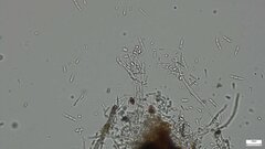 Isthmolongispora