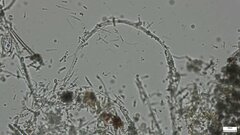 Isthmolongispora