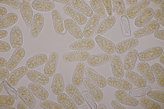 Melampsoridium betulinum