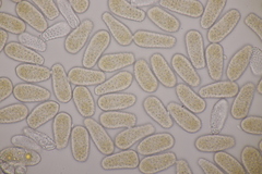 Melampsoridium betulinum