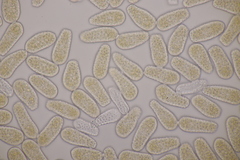 Melampsoridium betulinum