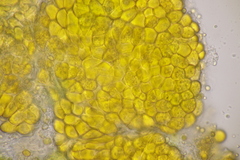 Melampsoridium betulinum