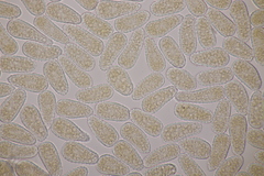 Melampsoridium hiratsukanum