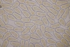 Melampsoridium hiratsukanum