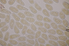 Melampsoridium hiratsukanum