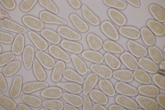 Melampsoridium hiratsukanum