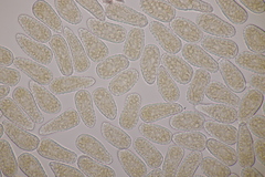 Melampsoridium hiratsukanum
