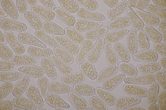 Melampsoridium hiratsukanum