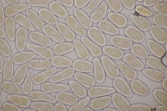 Melampsoridium hiratsukanum