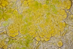 Melampsoridium hiratsukanum