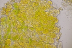 Melampsoridium hiratsukanum