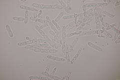 Mycosphaerellaceae
