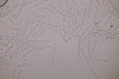 Mycosphaerellaceae