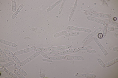 Mycosphaerellaceae