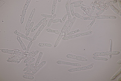 Mycosphaerellaceae