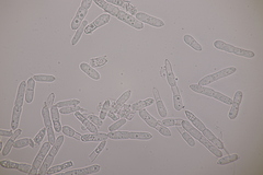 Mycosphaerellaceae