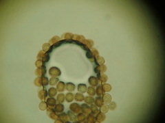 Puccinia acetosae