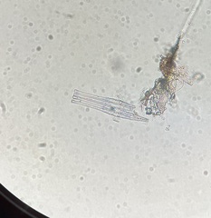 Fragilaria
