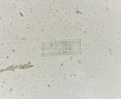Fragilaria