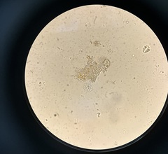 Amoebozoa