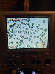 Cortinarius causticus