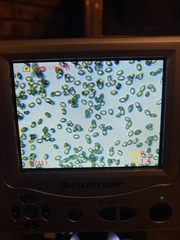 Cortinarius causticus