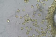 Trichia botrytis