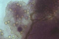 Trichia botrytis