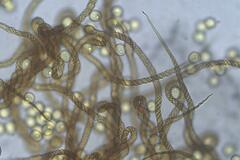 Trichia botrytis
